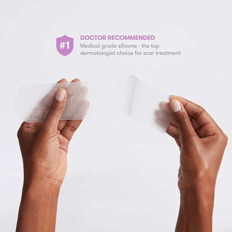 Medical Silicone Plasters for Cesarean Section Scar Frida Mom